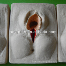 ISO 3 Set Model of Vulva Suturing Training Simulator